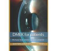 DMEK for patients: 99 of your most common questions answered