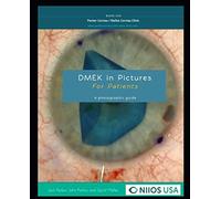 DMEK in Pictures, A patient's guide: a photographic guide