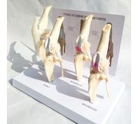Dog Knee Joint Model - Four-Stage Arthritis & Osteoporosis Anatomical Teaching Aid for Veterinary Education & Animal Lovers