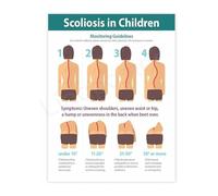 DPURPIWADY Posture and Spinal Alignment Guide Educational Anatomy Chart Canvas Wall-Art Poster for Office Study(Framed,16x24inch(40x60cm))