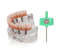 Dual-Arch Dental Implant Model All-On-6 & All-On-4 Overdenture Training System Transparent Maxilla & Mandible Bases, for Teaching/Surgical Demo