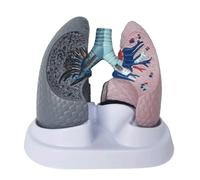 Dual-Sided Lung Anatomy Model, Healthy vs Diseased Lung Comparison Detachable Replica for Office, Educational Tool Human Torso Model