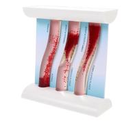 Dynamic Blood Vessel Anatomy Model 3-Stage Atherosclerosis Progression with Vascular Thickness and Plaque Comparison Human Torso Model