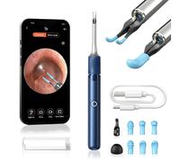 Ear Wax Removal Camera - Qimic 3-in-1 Ear Cleaner Earwax Removal Kit with Ear Pick & Tweezers, 8MP Wireless Otoscope with Light, 6 Pcs Ear Camera for Whole Family