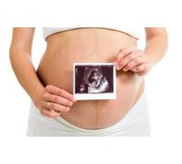 Early Baby Scan: From 7 Weeks