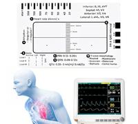ECG 7 Step Ruler Card for ECG/EKG Interpretation, Transparent Plastic EKG Calipers Measuring Tool, ECG Reference Guide, Easy-to-Carry ECG Ruler Follow a 7 Step Plan, Portable ECG/EKG Assessment Tool