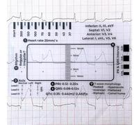 ECG 7 Step Ruler,ECG Ruler Plastic Ruler Measuring Tool,ECG 7 Step Ruler for ECG/EKG Interpretation,Transparent EKG Calipers Measuring Tool,Portable ECG Assessment Tool EKG Card,ECG Reference Guid
