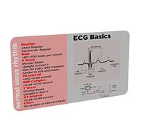 ECG Basics (Paramedic, Nurse, Student) Pocket Reference Card