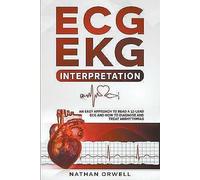 ECG/EKG Interpretation: An Easy Approach to Read a 12-Lead ECG and How to ...