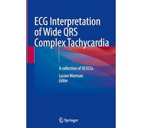 ECG Interpretation of Wide QRS Complex Tachycardia: A collection of 50 ECGs
