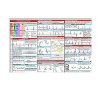 Ecg Pocket Poster, ECG Interpretation Science Poster, Tri Fold EKG Rhythm Interpretation Guide Posters, Rapid Analysis Measurement Tool for Nurses, EKG Techs, Students Studying
