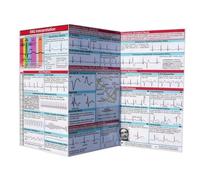 ECG Pocket Reference Card, Double-Sided Tri-fold Guide, EKG Rhythm Analysis Cards with Caliper for Nurses
