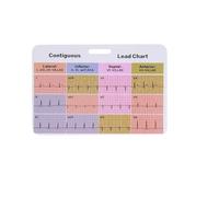 ECG Rhythm Pocket Card - Electrocardiogram Badge Card | Interpretation Tool Cardiac Reference Quick Interpretation 3 Piece Supplies for Clinical Telemetry