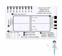 ECG RULER Pocketcard - Transparent EKG Calipers 7 Step Ruler for ECG/EKG Interpretation, ECG Measurement Tool, ID Sized for Medical Students & Family Essentials (1PC)