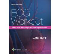 ECG Workout: Exercises in Arrhythmia Interpretation