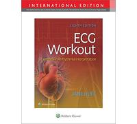 ECG Workout: Exercises in Arrythmia Interpretation