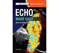 Echo Made Easy