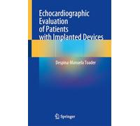 Echocardiographic Evaluation of Patients with Implanted Devices