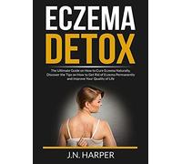 Eczema Detox: The Ultimate Guide on How to Cure Eczema Naturally, Discover the Tips on How to Get Rid of Eczema Permanently and Improve Your Quality of Life