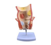Educational Anatomy Display Aid, PVC Pathology Cutaway Model for Classroom Demonstration, Lesson Training, Study Help Pathology Anatomy Model Digestive Teaching Aid Pvc Cutaway Display Classroom Study