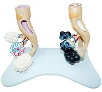 Educational Model Alveolar Model Comparative Smoking Alveoli and Healthy Alveoli Anatomy Study Model Human Organ Anatomical Model Models