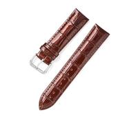 EDVENA 12mm 14mm 16mm 18mm 20mm 22mm Patent Leather Watch Band Replacement Genuine Leather Watch Strap Wrist Bracelet Wristband(Deep Brown,14mm)