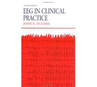 EEG in Clinical Practice