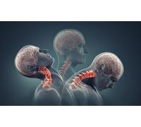 Effective Whiplash & Neck Pain Treatment: Regain Mobility & Relieve Pain with Expert Care