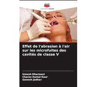 Effet de l'abrasion à l'air sur les microfuites des cavités de classe V
