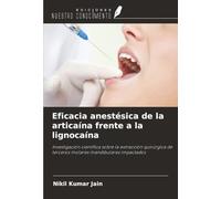 Eficacia anestésica de la articaína frente a la lignocaína: Investigación científica sobre la extracción quirúrgica de terceros molares mandibulares impactados