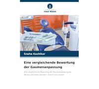 Eine vergleichende Bewertung der Gaumenanpassung: Eine vergleichende Bewertung der Gaumenanpassung bei flachen und tiefen Gaumen - Eine In-vitro-Studie