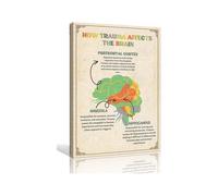 EKFBQBGW How Trauma Affects The Brain Chart Poster Brain Wall-Art Office Decor Mental Health Poster Prints Contemporary Artwork Framed,12x18inch(30x45cm)