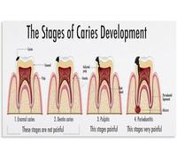 EKFBQBGW Smile Science A Visual Narrative of Oral Care Poster Canvas Wall-Art for Modern Study or Holistic Living Room Decor Unframed,16x24inch(40x60cm)