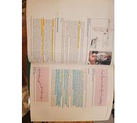 EKG Plain and Simple