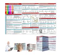 EKG Pocket Guide Card - Double Sided Visual Study Reference for ECG Waveforms, Heart Rhythm Patterns & Cardiac Education - Compact Tri-Fold Portable Card for Students & Medical Enthusiasts