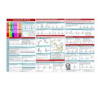 Ekg Pocket Guide, Ecg Pocket Card, EKG Rhythm Interpretation, Double Sided Portable EKG Reference Card Interpretation Book For Nurse, Students (1)
