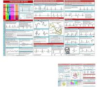 EKG Pocket Guide, EKG Rhythm Interpretation, Double Sided Compact Portable Reference Card, Rapid Interpretation EKG Pocket Nurses Guide, Paramedic Flashcards, EKG Interpretation Book (1pcs)