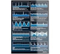 EKG Rhythm Interpretation Dual Sided for Nursing/Medical Students - Pocket ECG/EKG Cheat Card for Exam Study