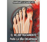 EL MEJOR TRATAMIENTO PARA LA UÑA ENCARNADA: PARA DEPORTISTAS Y DEMÁS PERSONAS QUE HAN SIDO TRATADAS CON CIRUGÍA DE UÑA ENCARNADA Y AÚN NO TIENEN UNA SOLUCIÓN