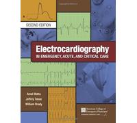Electrocardiography in Emergency, Acute, and Critical Care