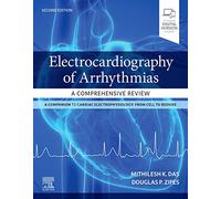 Electrocardiography of Arrhythmias: A Comprehensive Review: A Companion to Cardiac Electrophysiology