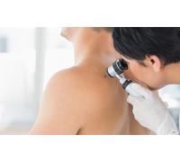 Electrocauterisation of three skin tags for the same person; may be repurchased every 90 days