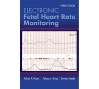 Electronic Fetal Heart Rate Monitoring: The 5-Tier System : The 5-Tier System