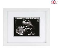 Elegant White Sonogram Keepsake Frame for Cherishing Baby's First Moments
