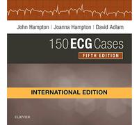 Elsevier 150 ECG Cases