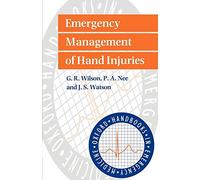 Emergency Management of Hand Injuries: 17 (Oxford Handbooks in Emergency Medicine)