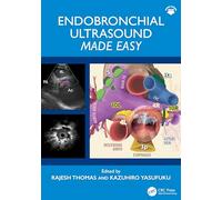 Endobronchial Ultrasound Made Easy: Made Easy