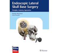 Endoscopic Lateral Skull Base Surgery – Principles, Anatomy, Approaches – Thieme