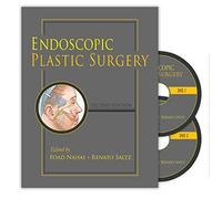 Endoscopic Plastic Surgery