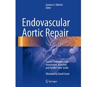 Endovascular Aortic Repair: Current Techniques with Fenestrated, Branched and Parallel Stent-Grafts
